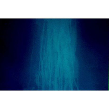 ウォーターフォール#18